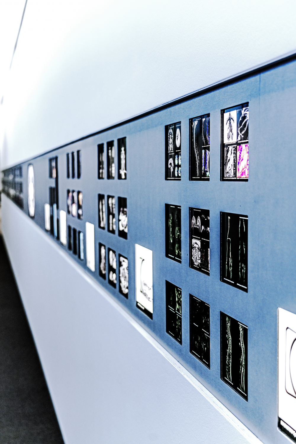 Überblickswand  im Kundenzentrum, u.a. mit  klinischen MR-Bilder