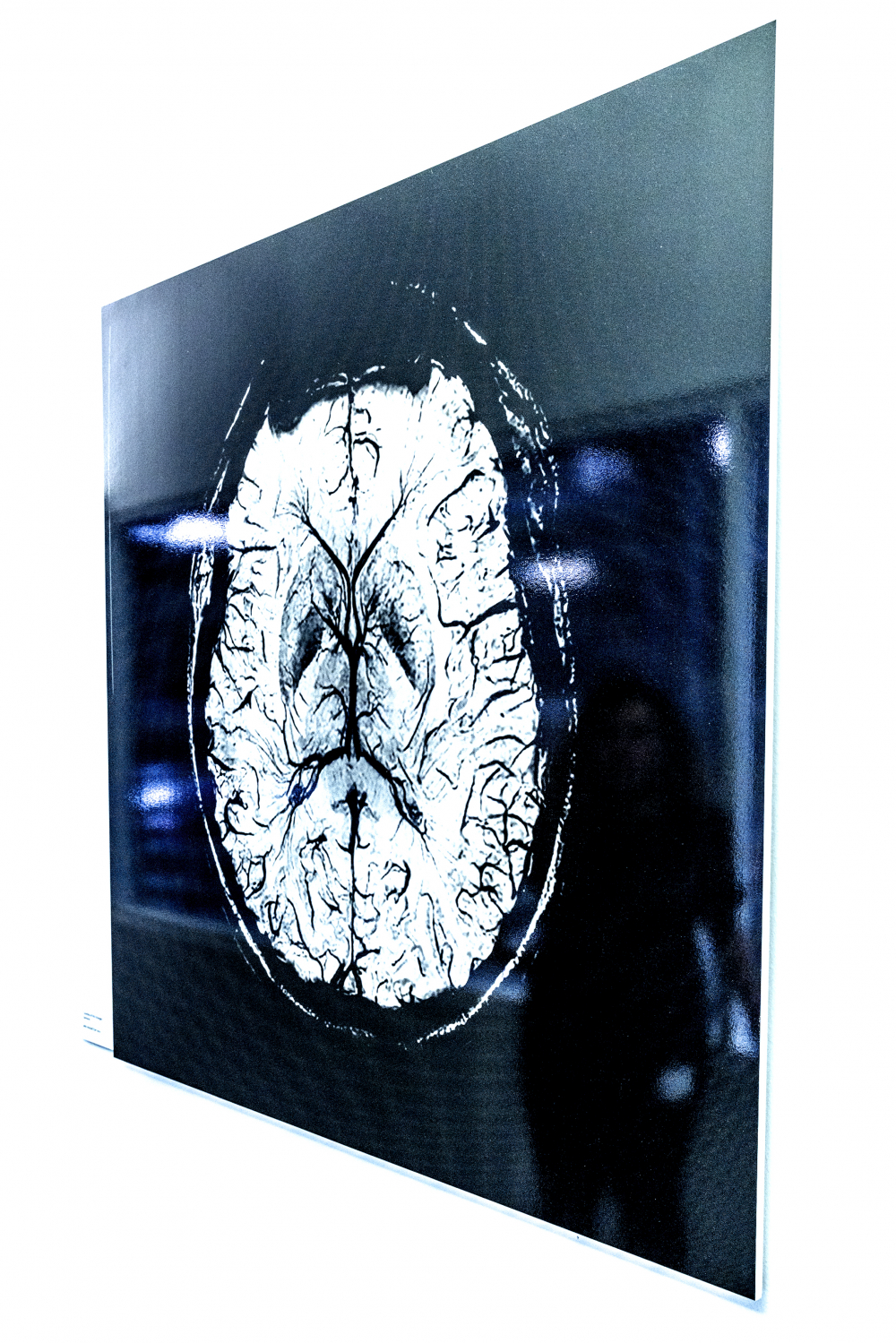 Klinisches Bild – Kopfaufnahme