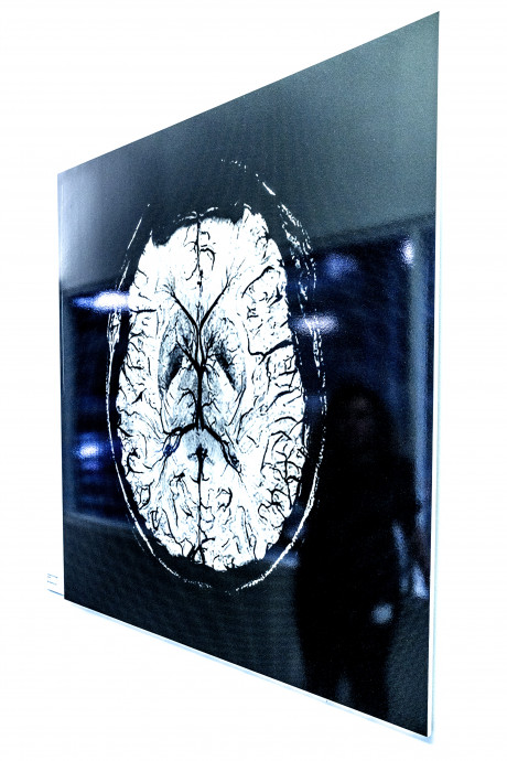 Klinisches Bild – Kopfaufnahme