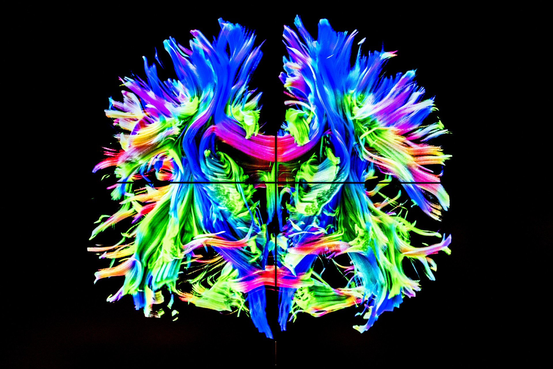 Cinematic-Rendering-Darstellung der Nervenfasern im Gehirn auf Basis von Magnetresonanz-Daten im Siemens Healthineers Experience Center, Forchheim.